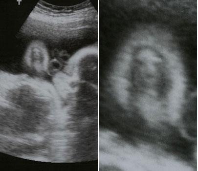 jesus-baby-scan-ultrasound.jpg