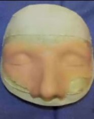 091001_prosthetic_face
